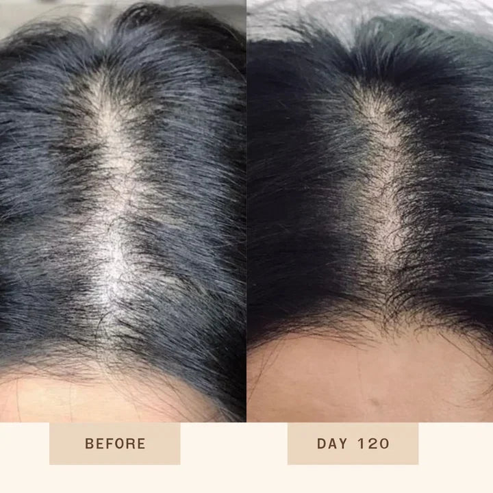 Proskire Anti-Grey Hair Serum - Controls Hair Fall