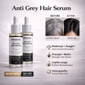 Proskire Anti-Grey Hair Serum - Controls Hair Fall