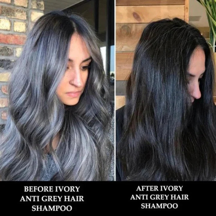 Proskire Anti-Grey Hair Serum - Controls Hair Fall