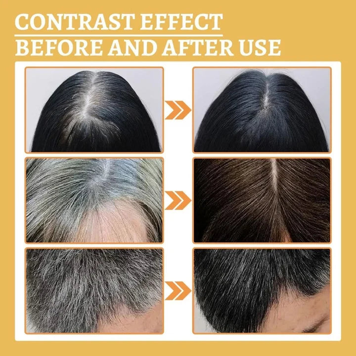 Proskire Anti-Grey Hair Serum - Controls Hair Fall